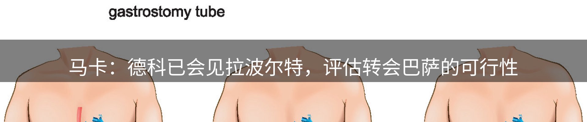 赛事资讯